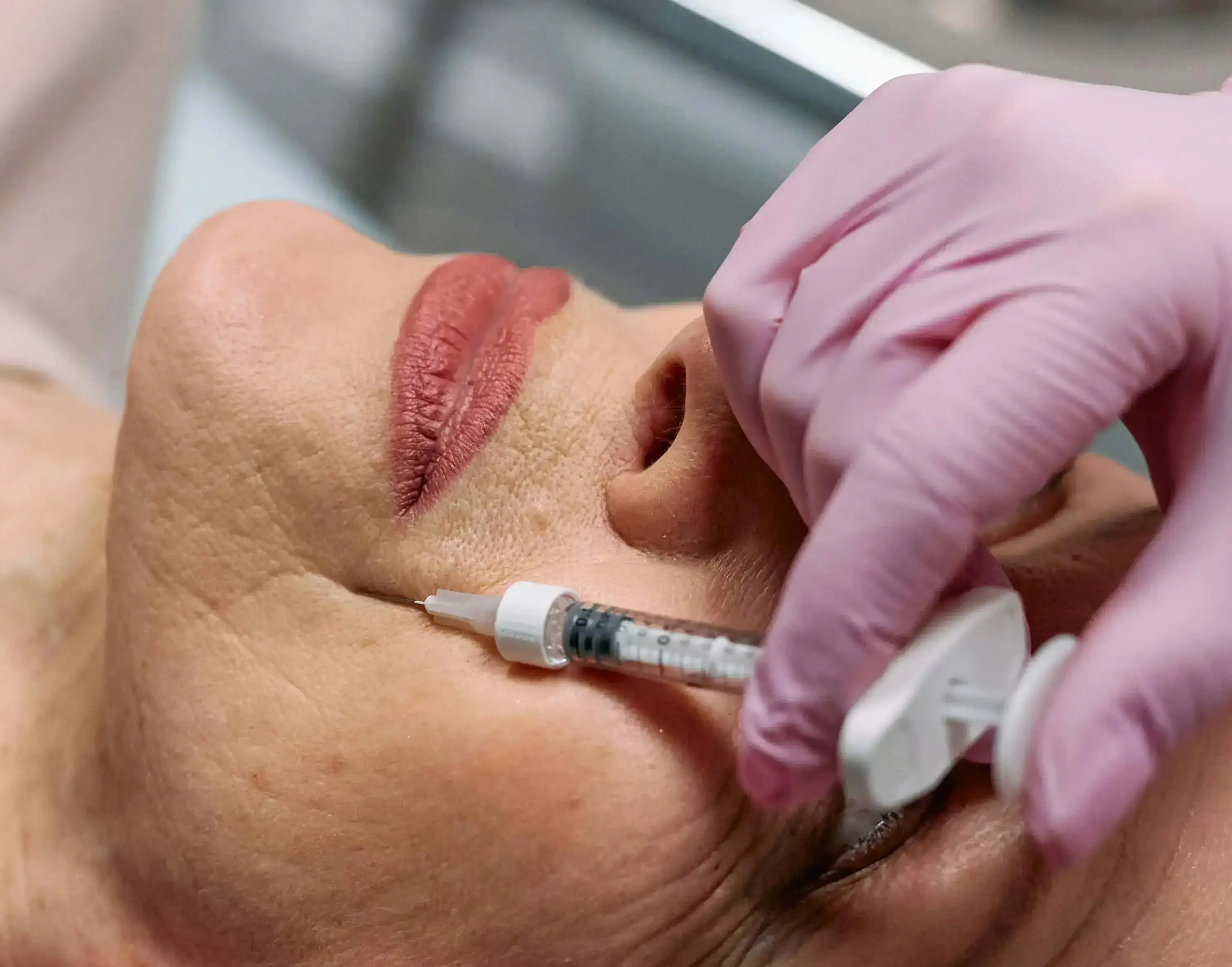 The Ultimate Guide to Botox Injections - What to Expect and How It Works